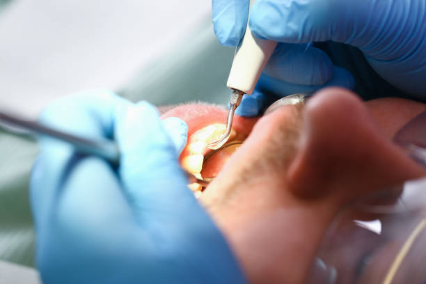 Best Broken or Cracked Tooth Emergency Dentist in Pleasant Valley, MO