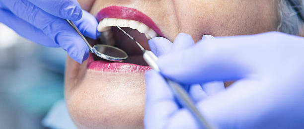 Best Emergency Dentist for Knocked-Out Tooth in Pleasant Valley, MO